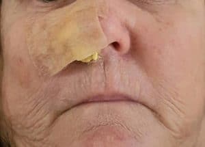 skin cancer pic1 mylifestyle.au